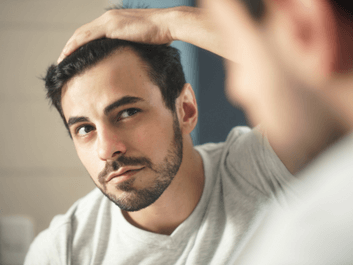 A férfiak rémálma a hajhullás